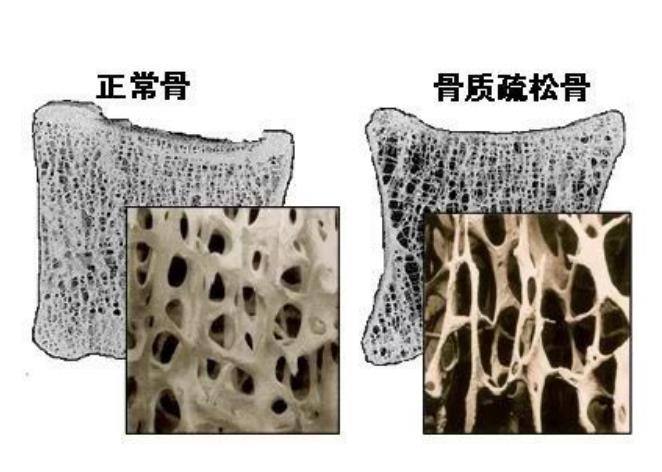 探究骨骼的秘密：從結構功能到健康守護