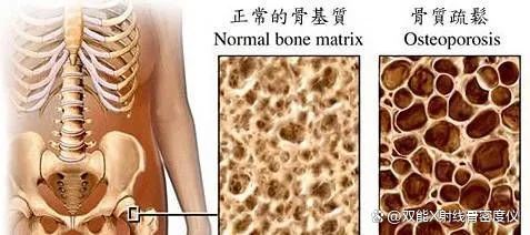 探究骨骼的秘密：從結構功能到健康守護